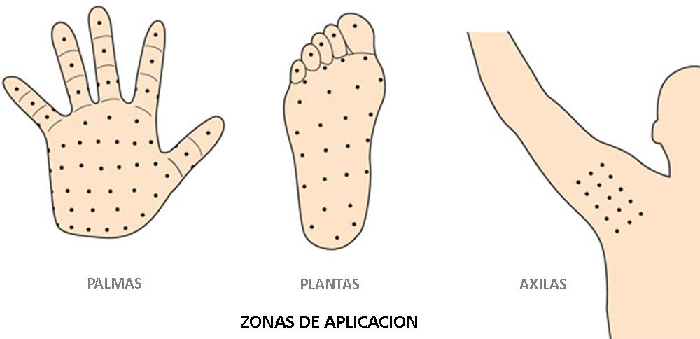 Zonas de aplicación